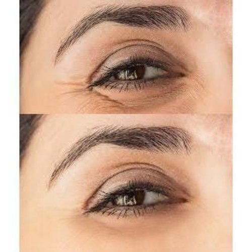 Advanced Biotic Repair Eye Treatment for Radiant Visionβ β
- Image 5