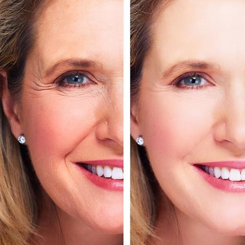 Youth Treatment β¨ Eye & Night Cream ποΈπ Anti-Aging, Hydrating, Wrinkle Repair, Collagen Boost πͺπ°π± 100% Vegan & Cruelty-Free ππ - Image 4