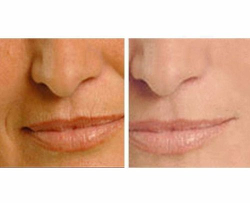 Age Perfect Night Repair Cream & Vitamin C Serum π restores glow & firms skin π - Image 6