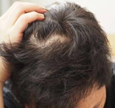 Baby Hair® scalp-first hair care
